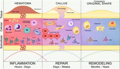 Towards in silico Models of the Inflammatory Response in Bone Fracture Healing